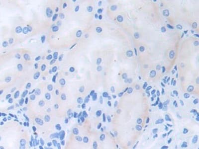 CDCP1 Antibody (aa689-836, APC)