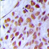 MRE11A / MRE11 Antibody (Internal)