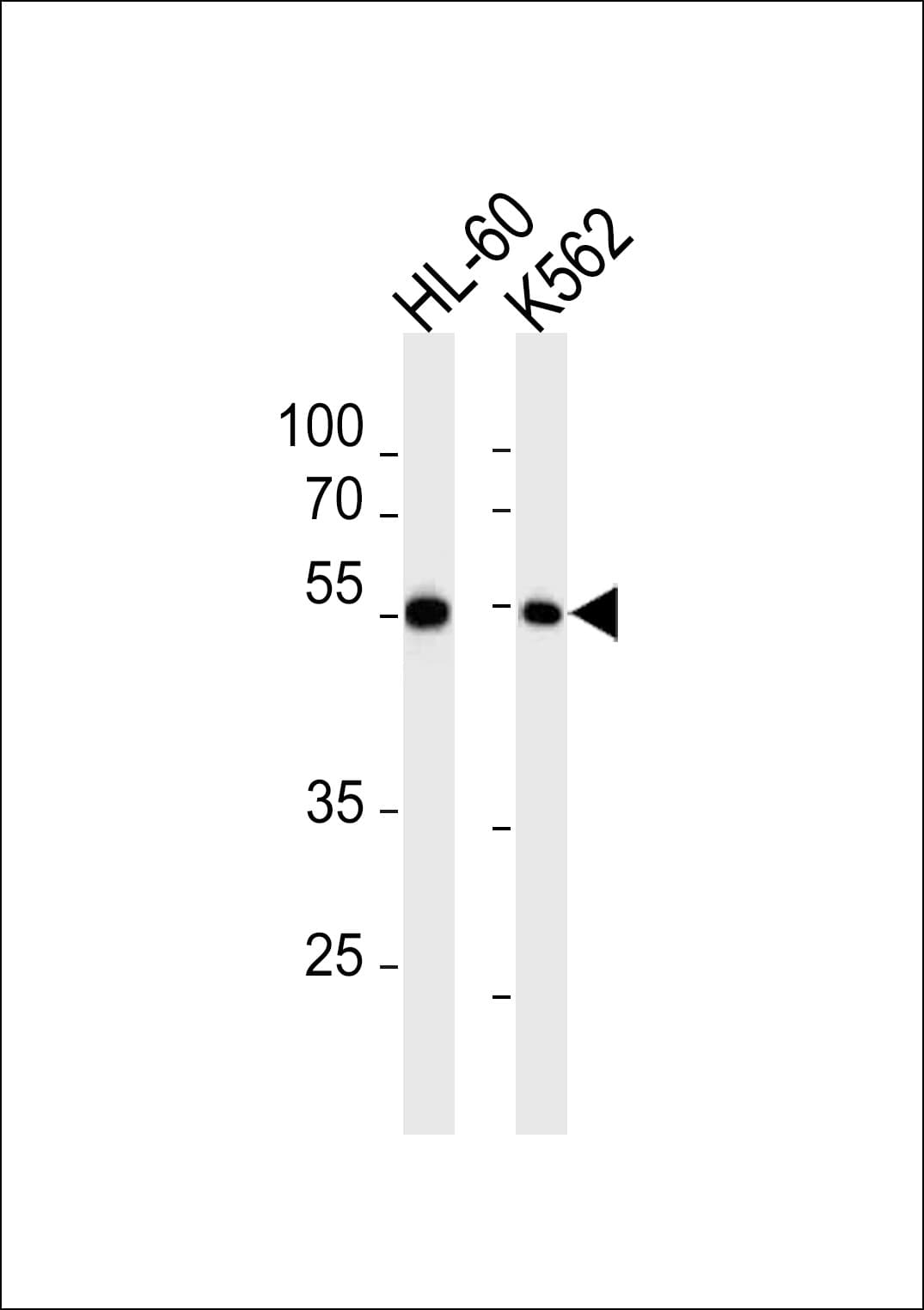 MEF2C Antibody (Ser387)