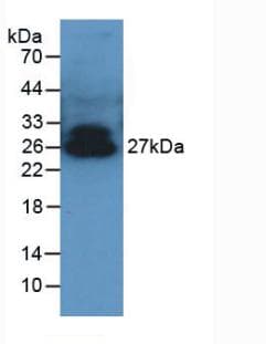 Adiponectin Antibody (aa17-243, APC)