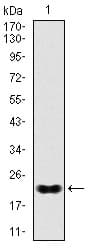 NKX2-2 Antibody (clone 3E4)