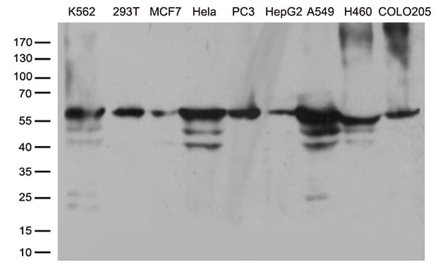 Monoclonal Mouse anti-Human CCT4 / SRB Antibody (clone OTI1A3, WB)