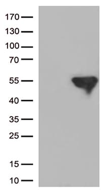IKBKG / NEMO / IKK Gamma Antibody (clone OTI12B11)