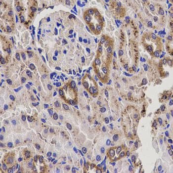 EPHX2 / Epoxide Hydrolase 2 Antibody