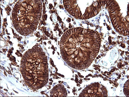 Monoclonal Mouse anti-Human SCAMP2 Antibody (clone OTI1H10, IHC, WB)