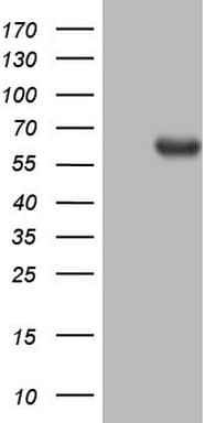 Monoclonal Mouse anti-Human PROZ / Protein Z Antibody (clone OTI3A11, aa115-400, WB)