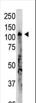 OAS3 / p100 Antibody (aa1056-1087)