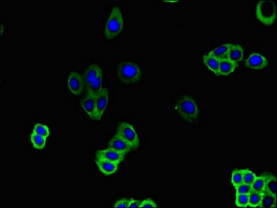 SLC51B / OSTBETA Antibody