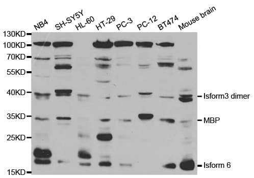 Polyclonal Rabbit anti-Human MBP / Myelin Basic Protein Antibody (IHC, IF, WB)