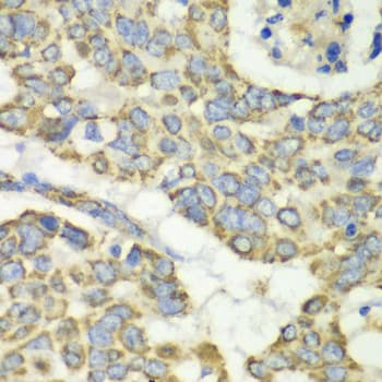 EFTU / TUFM Antibody