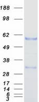 Human ESRRG / ERR Gamma Protein (Recombinant Myc-DDK (Flag))