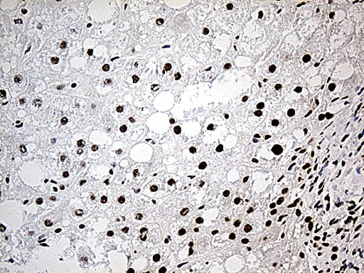 Monoclonal Mouse anti-Human DDX39B / UAP56 Antibody (clone OTI8B8, aa319-428, IHC, WB)
