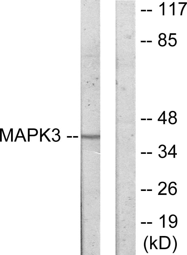 MAPKAPK3 Antibody (aa301-350)