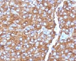 CHGA / Chromogranin A Antibody (clone bGRAN9, Ready-to-Use)