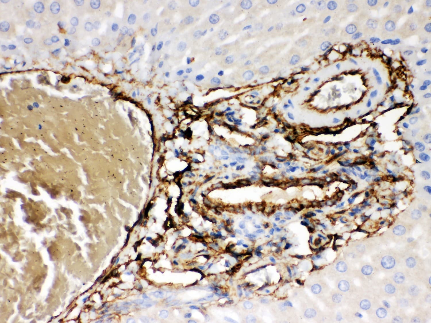 ABCB4 / MDR3 Antibody (aa601-720)