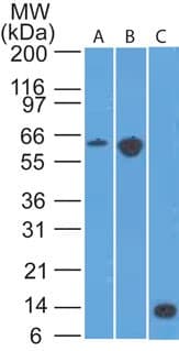 CCR6 Antibody (clone 18B9E6)