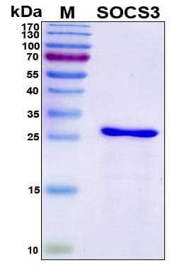 Human SOCS3 Protein (Recombinant His, N-Terminal)