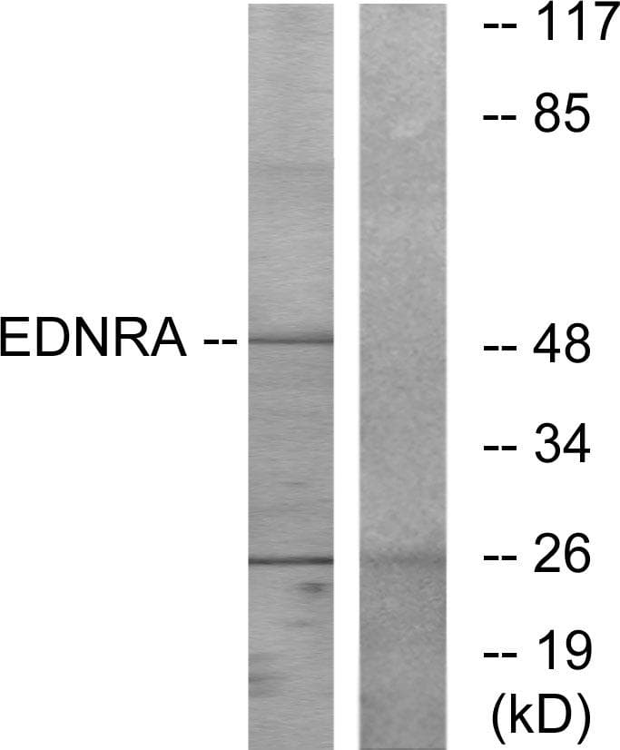 Polyclonal Rabbit anti-Human EDNRA / Endothelin A Receptor Antibody (IF, WB)