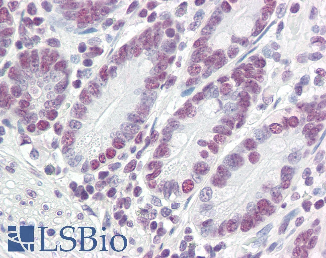 IHC-plus™ PTBP1 Antibody (aa2-14)
