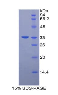 Mouse ITGB3 / Integrin Beta 3 / CD61 Protein (Recombinant His-S)