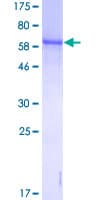 Human GLUL / Glutamine Synthetase Protein (Recombinant GST)
