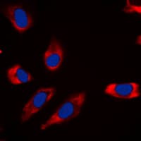 GSK3A / GSK3 Alpha Antibody (N-Terminus)