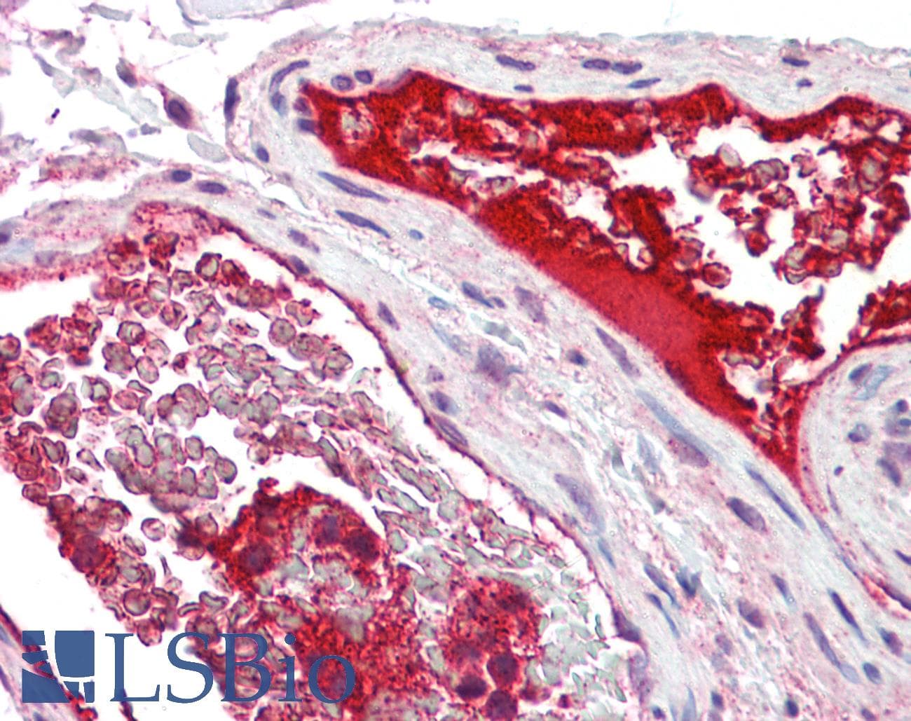 IHC-plus™ CLEC7A / Dectin 1 Antibody