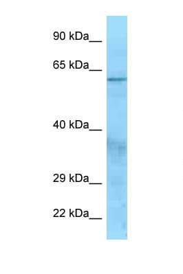 CFI / Complement Factor I Antibody (aa145-194)