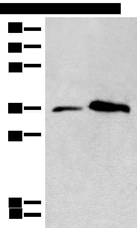 Polyclonal Rabbit anti-Human CD86 Antibody (IHC, WB)