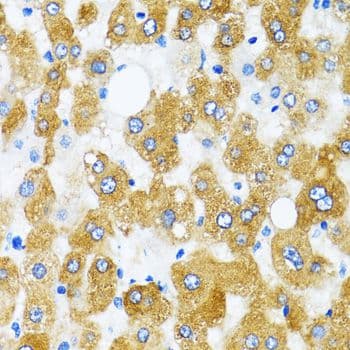 GABARAP Antibody