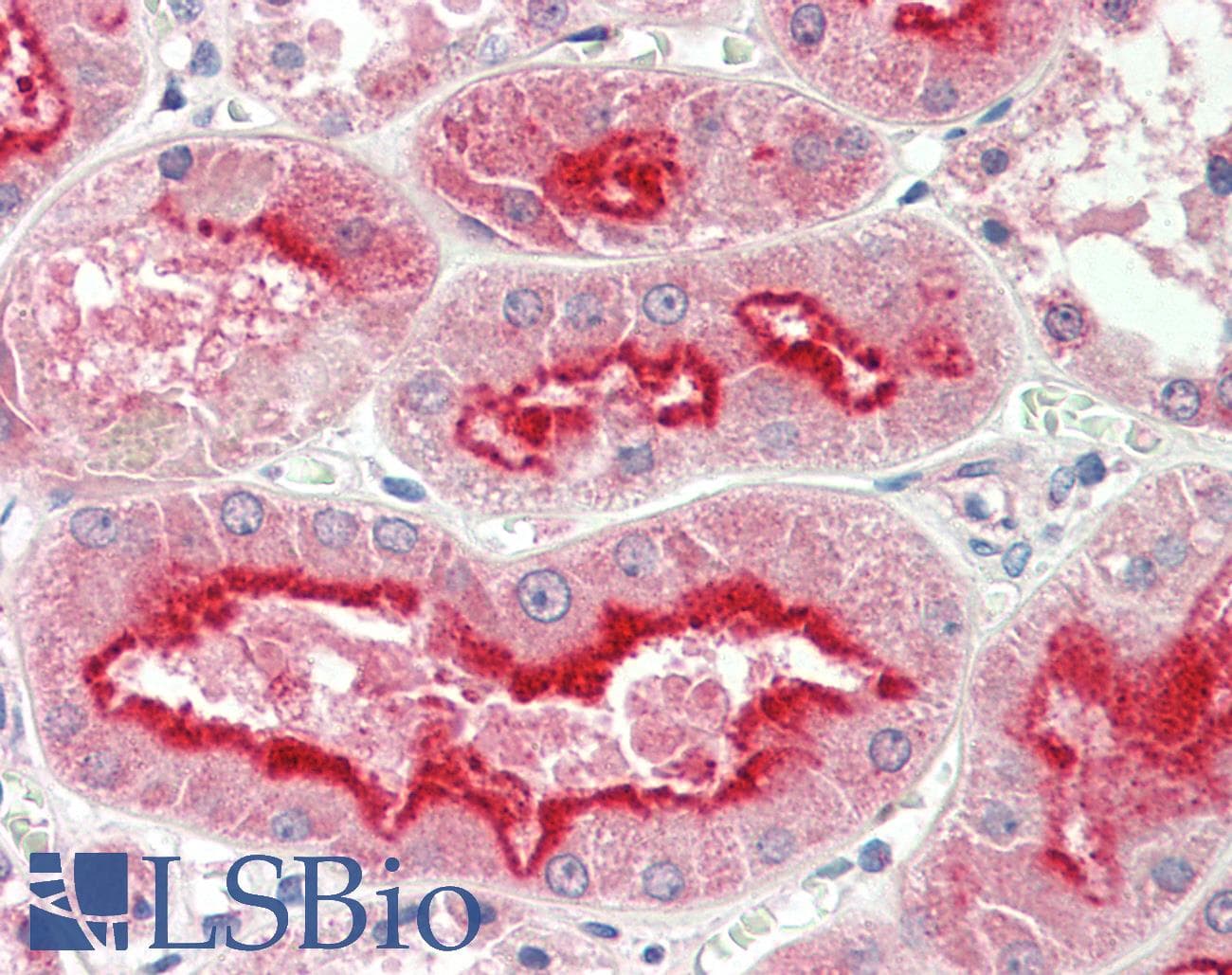 APMAP / C20orf3 Antibody (aa74-123)