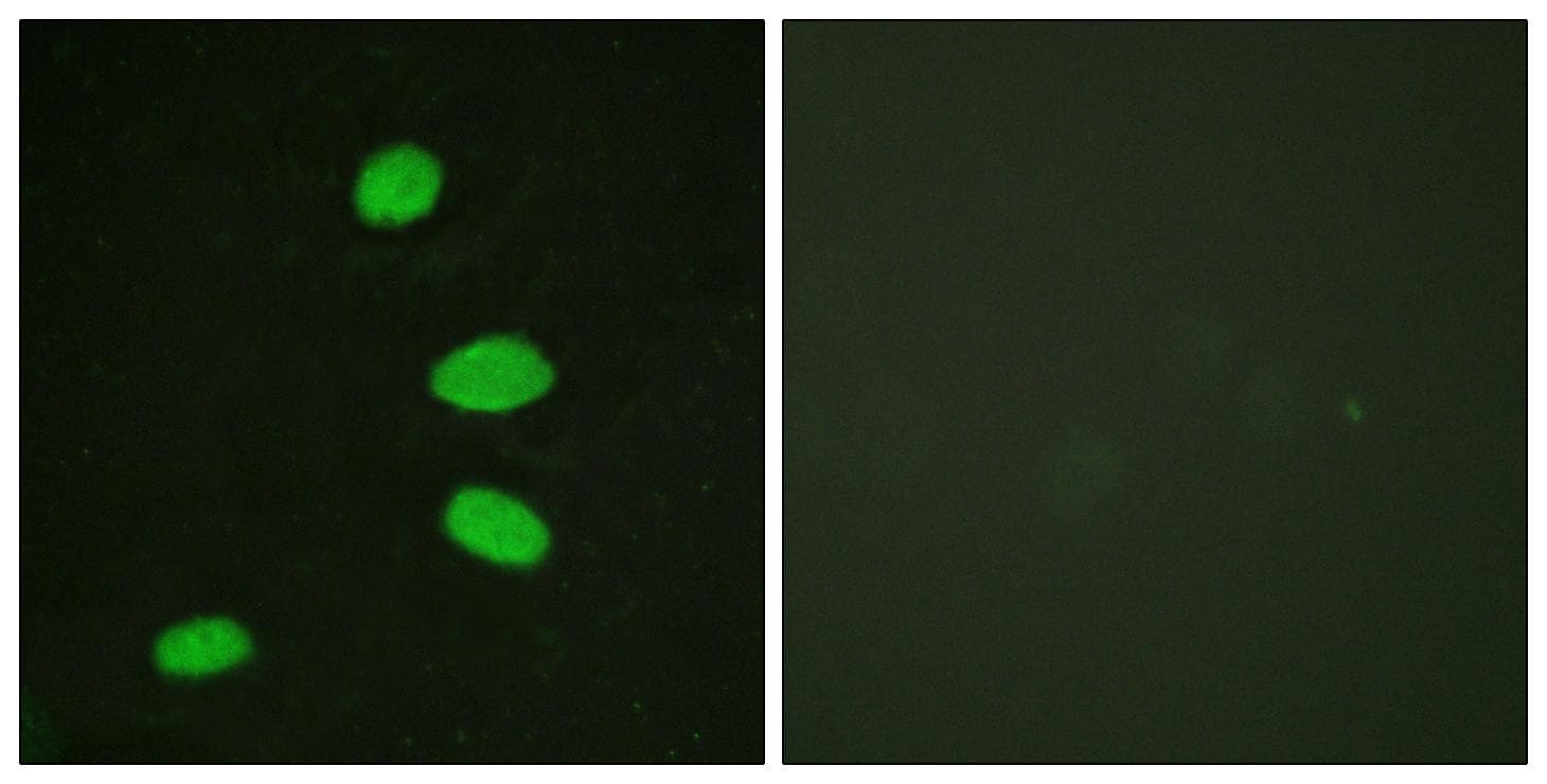 Polyclonal Rabbit anti-Human RBL2 / RB2 p130 Antibody (Ab-952, IF)