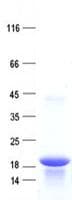 Human HCFC1R1 / HPIP Protein (Recombinant His, N-Terminal)