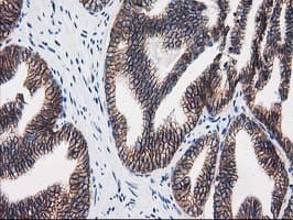 CTNNB1 / Beta Catenin Antibody (clone OTI9H2, Carrier-free)