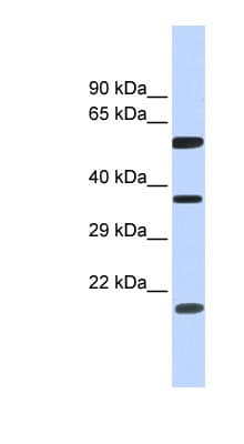 Polyclonal Rabbit anti-Human NT5DC1 Antibody (aa107-156, WB)