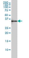 IHC-plus™ SDSL / Serine Dehydratase-Like Antibody (clone M2)