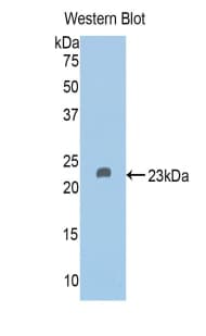 GC / Vitamin D-Binding Protein Antibody (aa209-394, APC)