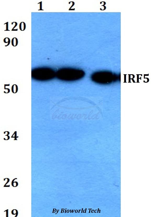 Polyclonal Rabbit anti-Human IRF5 Antibody (WB)