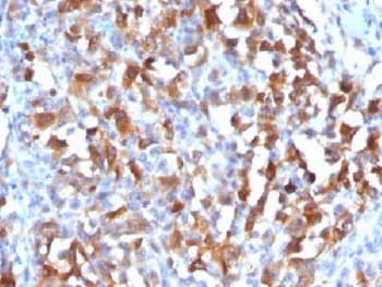 MLANA / Melan-A Antibody