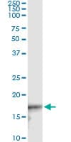 CDKN2D / p19 INK4d Antibody (clone 2E10)