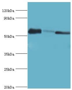 Polyclonal Rabbit anti-Human SMYD1 Antibody (aa1-350, IHC, WB)