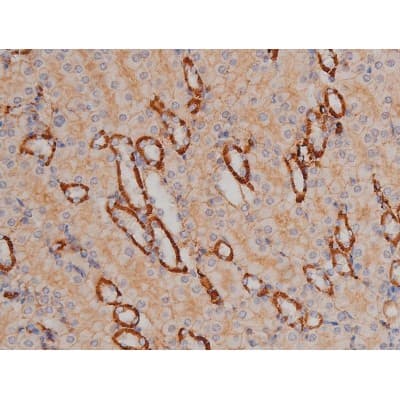 SYN / FYN Antibody (phospho-Tyr530)