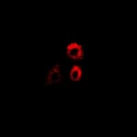 PTRH2 / BIT1 Antibody