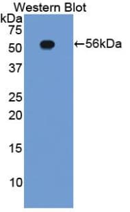 ITGB2 / CD18 Antibody (aa124-363)