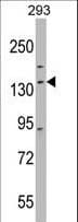 Polyclonal Rabbit anti-Human DHX30 Antibody (aa25-53, WB)