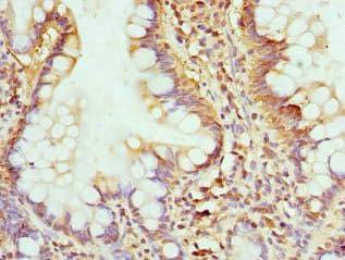 GMPS / GMP Synthase Antibody