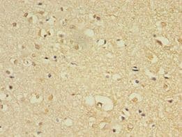FLRT1 Antibody (Biotin)