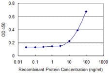 ALOX15B / 15-LOX-2 Antibody (clone 4A7)