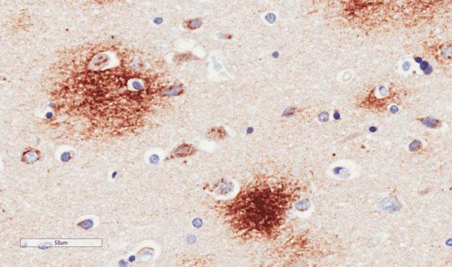 APP / Beta Amyloid Precursor Antibody (Amyloid Beta, clone 6E10)