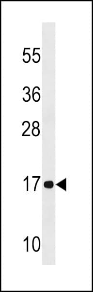 Polyclonal Rabbit anti-Human NDUFA12 / B17.2 Antibody (aa105-133, WB)